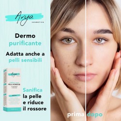 Crema Brufoli: Trattamento Anti brufoli e Punti Neri per Pelli Acneiche , Rimedio Specifico e Purificante da 50ml